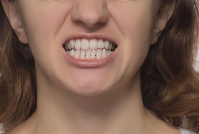 piximaperfect PS修图教程 黄色牙齿的变白 收集整理 第1张